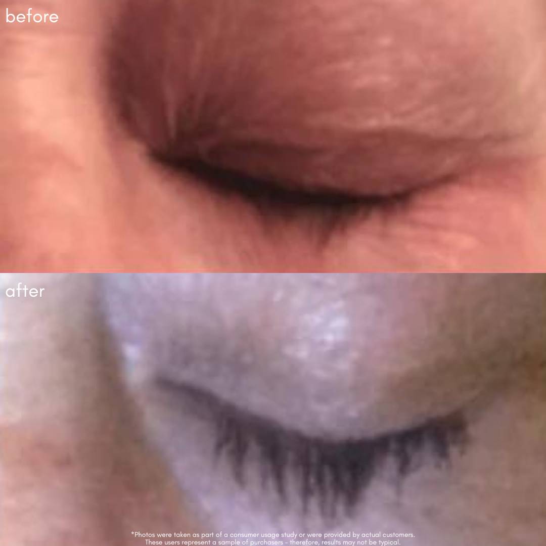 Power Fol Lash & Brow Before & After
