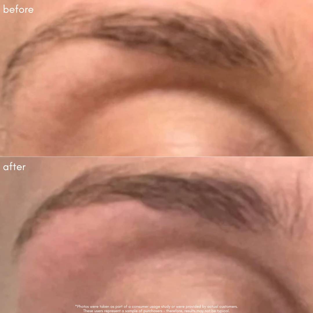 Power Fol Lash & Brow Before & After