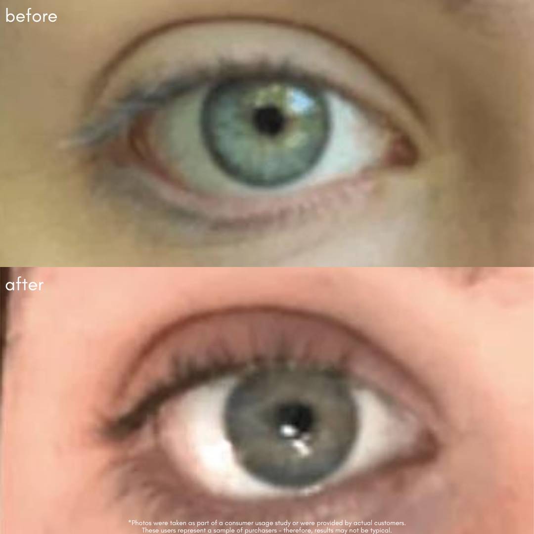 Power Fol Lash & Brow Before & After