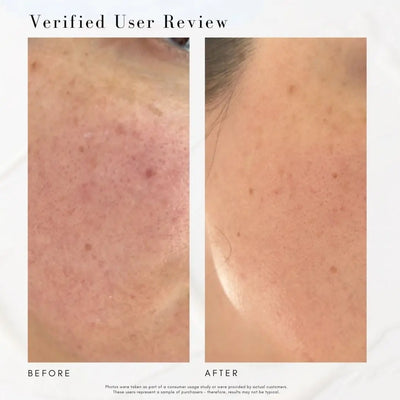 The Advanced Response Complex - Face & Neck Moisture Cream Maya Chia