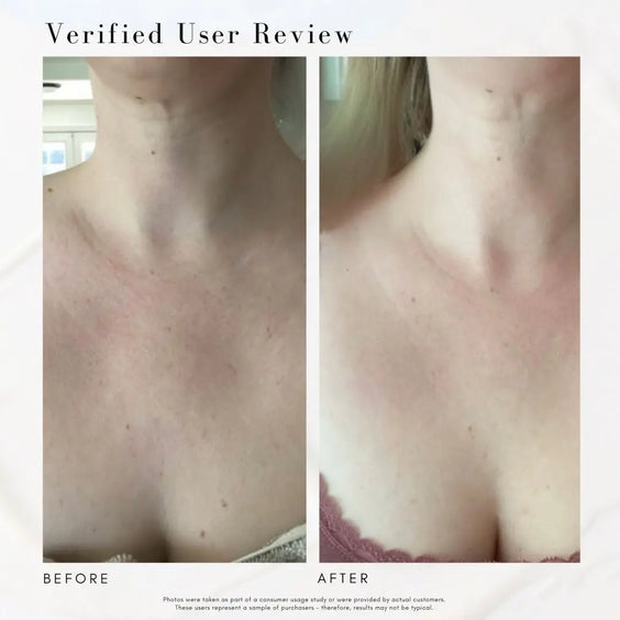 The Advanced Response Complex - Face & Neck Moisture Cream Maya Chia
