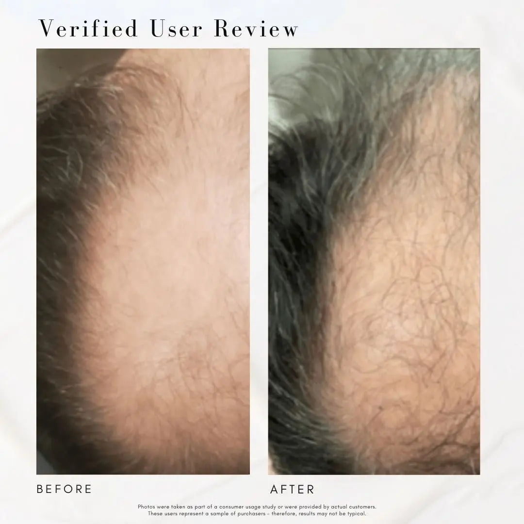 Power Fol™ - Advanced Multi-Correctional Scalp & Hair Treatment Maya Chia