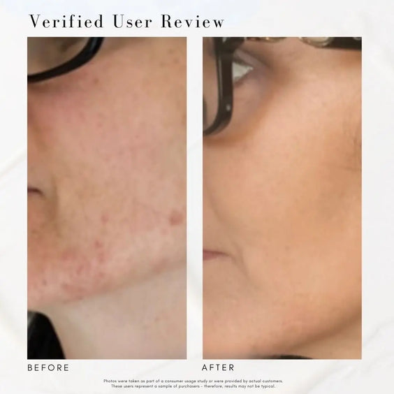 The Straight A - Advanced Gentle Retinol Serum Maya Chia