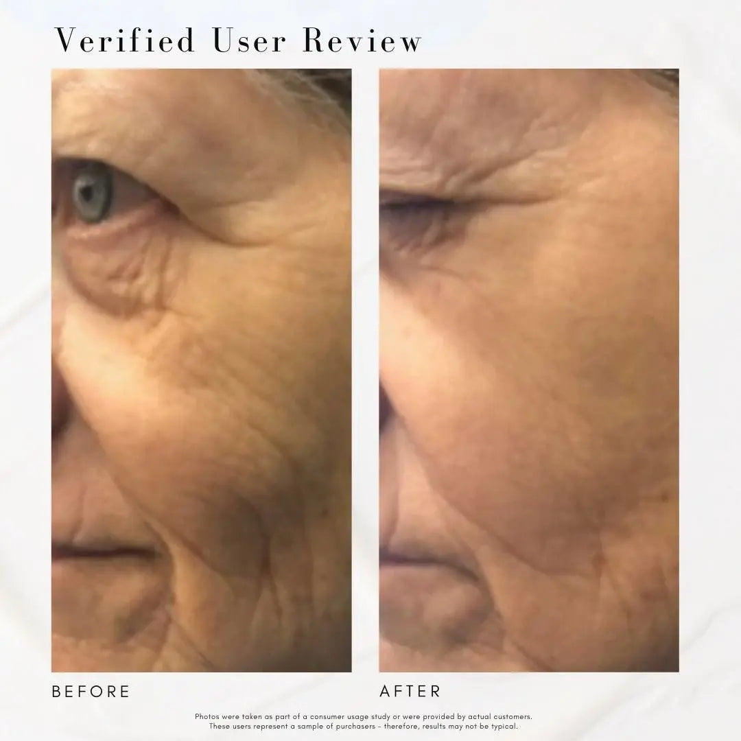 The Super Lift - Concentrated Vitamin C-More treatment Maya Chia