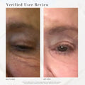 The Super Lift - Concentrated Vitamin C-More treatment Maya Chia