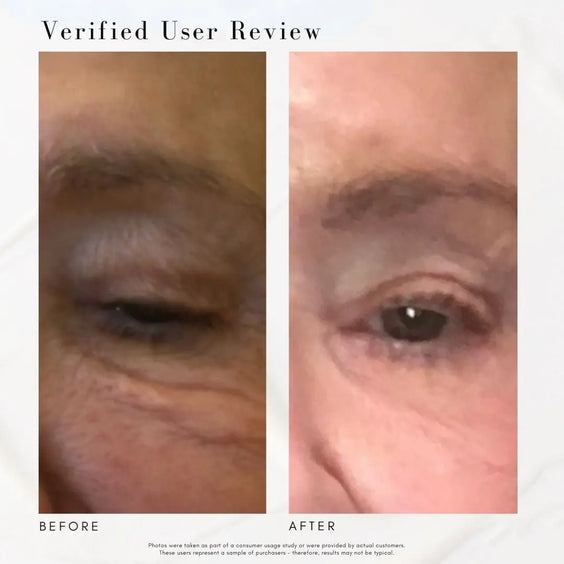 The Super Lift - Concentrated Vitamin C-More treatment Maya Chia
