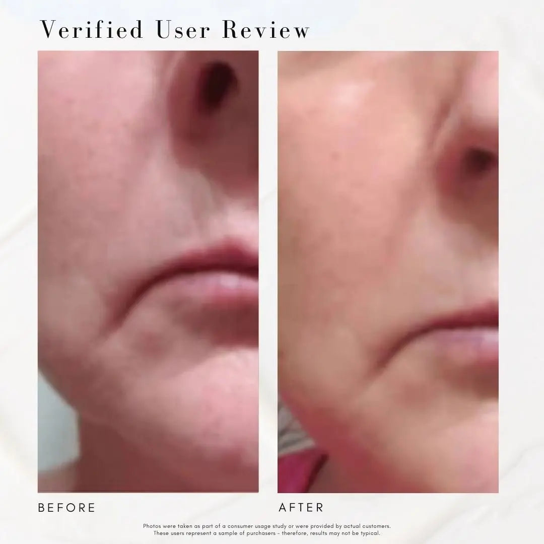The Super Lift - Concentrated Vitamin C-More treatment Maya Chia