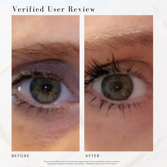 The Super Lift - Concentrated Vitamin C-More treatment Maya Chia