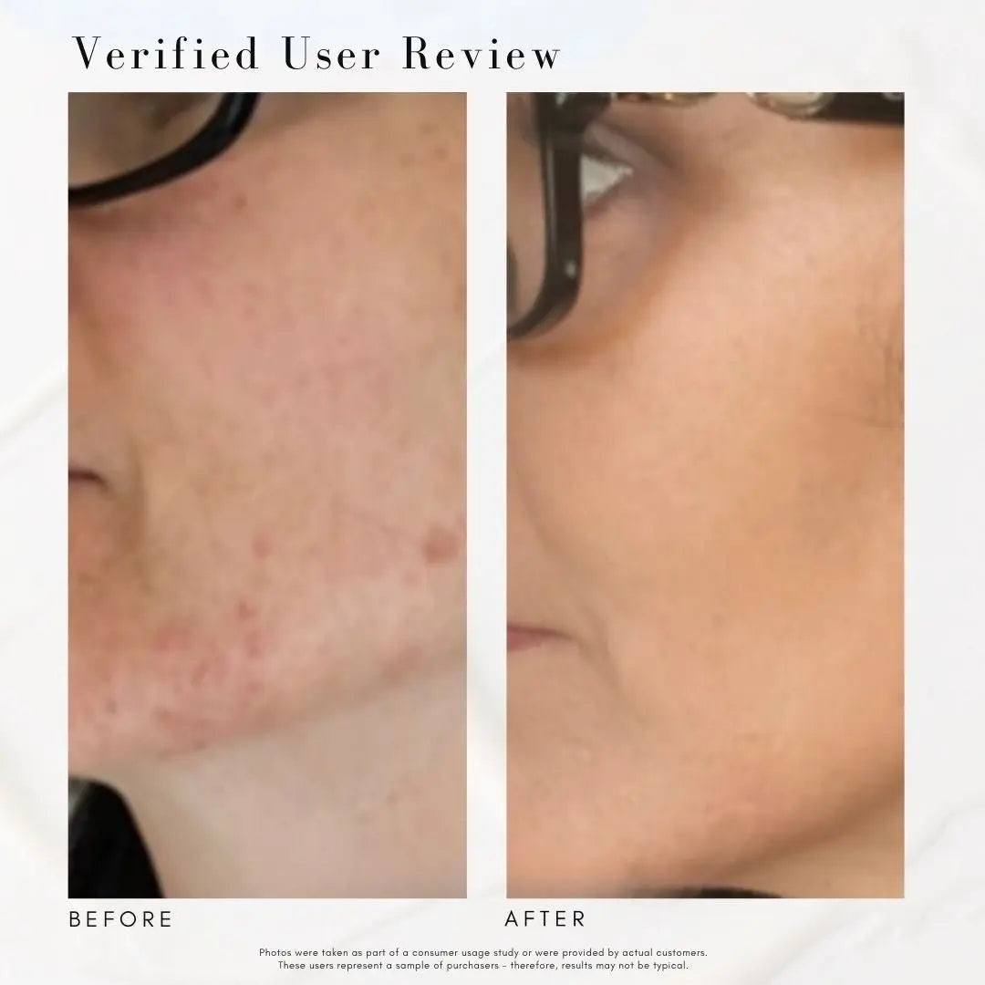 The Skin Refresh Bundle Maya Chia